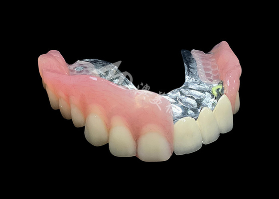 comprare Migliora il tuo sorriso con il ponte della corona PFM naturale e le dentiere rimovibili online manufacture