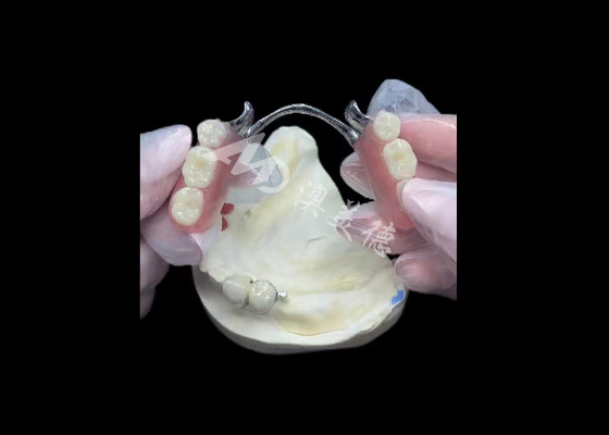 comprare Porcellana resistente fusa al metallo corona dentale PFM corona per il restauro online manufacture
