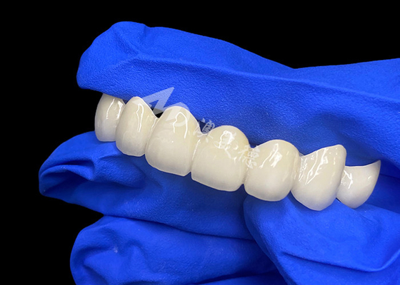 comprare Alta traslucidità di lava zirconia ponte dentale miscela senza cuciture con denti naturali online manufacture