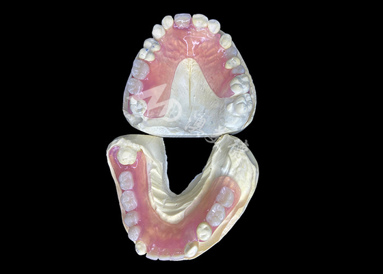 comprare Protesi parziale flessibile Valplast per il massimo comfort ed estetica online manufacture