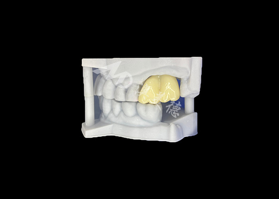 comprare Corona dentale in zirconia solida Durabilità garantita Molar dal laboratorio dentale cinese online manufacture