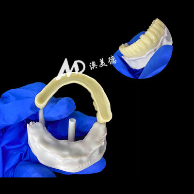 comprare Ponte provvisorio per impianti in PMMA con interno cavo per stabilità e guarigione naturale, fabbricazione CAD/CAM ad alta precisione, materiale PMMA biocompatibile online manufacture