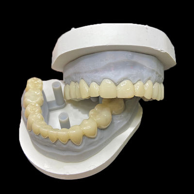 comprare PMMA Restorazioni temporanee CAD/CAM PMMA Corone e ponti per casse dentali provvisorie online manufacture
