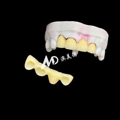comprare Premium Ceramic Crowns and Bridges for High-Strength, Natural Aesthetics and Long-Lasting Clinical Performance online manufacture