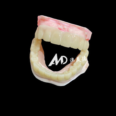 comprare Lightweight PMMA Temporary Bridges with Hollow Design for Implant Restorations online manufacture