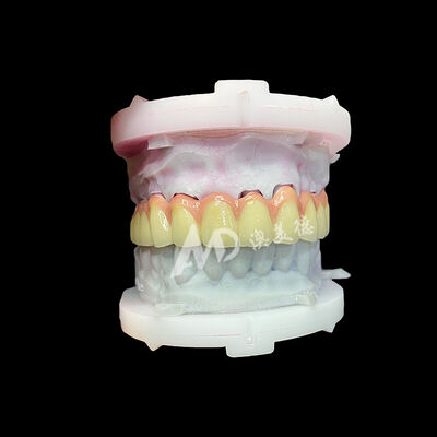 comprare Corona e ponte in ceramica di titanio puro Restorazioni estetiche leggere e durevoli online manufacture