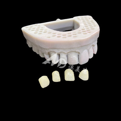 comprare IPS Emax Veneers Veneers dentali di porcellana di alta qualità per un sorriso naturale online manufacture