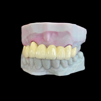 comprare Porcellana fusa al metallo (PFM) corona con cornice Co-Cr online manufacture