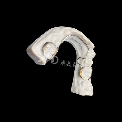 comprare Arco linguale personalizzato con fasce Apparecchio ortodontico per la manutenzione dello spazio e l'allineamento dentale online manufacture