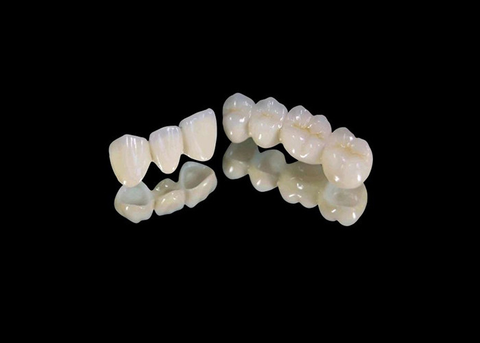 Corona dentale in zirconia resistente all'usura con resistenza ai frammenti e alle macchie e estetica naturale dal laboratorio dentale cinese