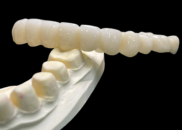 Vita Classical Shade All Ceramic Crown Bridge Naturale alla ricerca di restauro dentale
