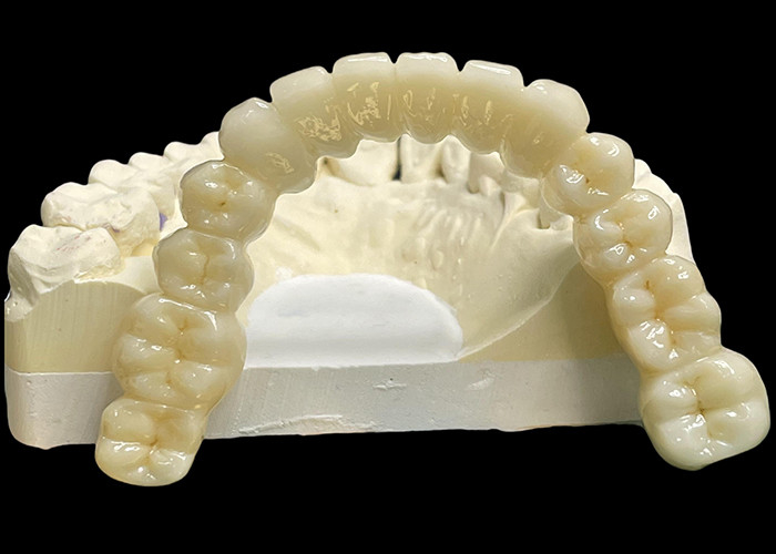 Vita Classical Shade All Ceramic Crown Bridge Naturale alla ricerca di restauro dentale