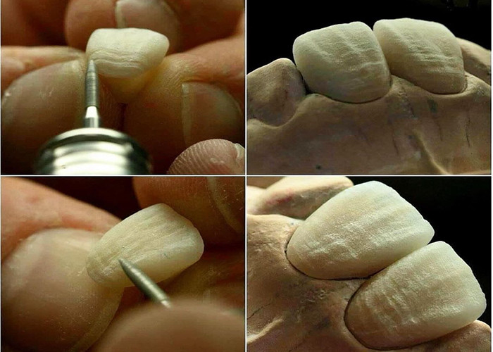 Lunga durata resistente all'usura Forza tutto ponte corona in ceramica con eccellente biocompatibilità per il restauro dentale