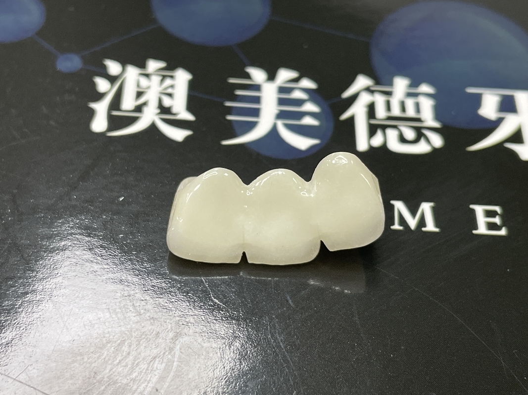 Corone di ceramica traslucida per il restauro dentale con facile pulizia e risultati duraturi