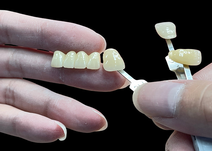 Resistente alle macchie Tutto ponte di porcellana Comodo adatto per la restaurazione dentale