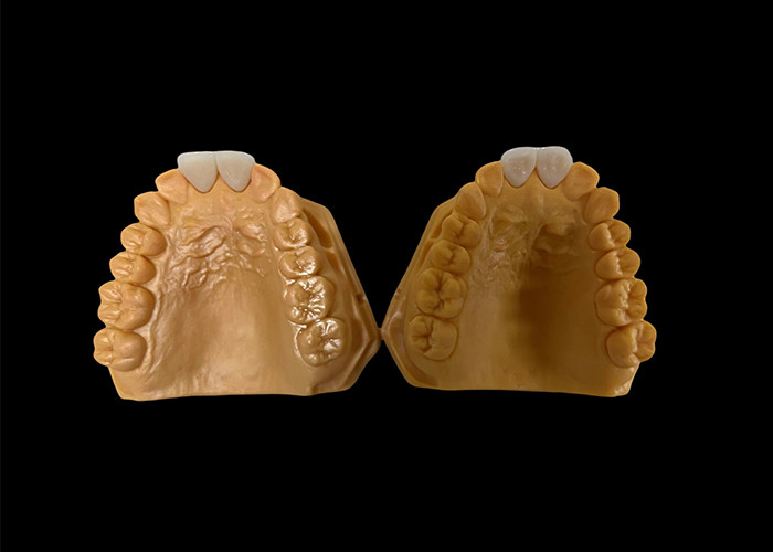 Corona dentale in zirconia estetica personalizzata perfettamente adattata per denti anteriori e posteriori