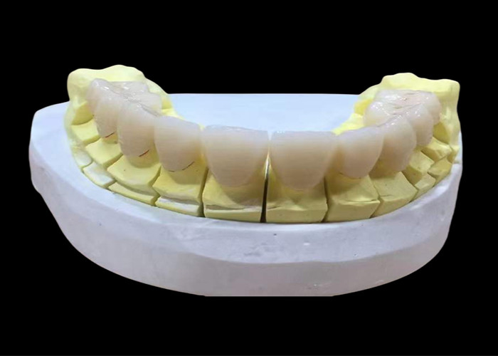 Corona dentale in porcellana di zirconia con finitura estetica e naturale proveniente dal laboratorio dentale cinese