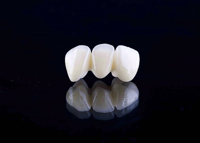 Corona dentale in porcellana di zirconia con finitura estetica e naturale proveniente dal laboratorio dentale cinese