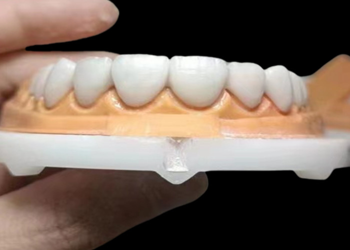 Corona dentale di zirconia traslucida su misura resistente alle macchie