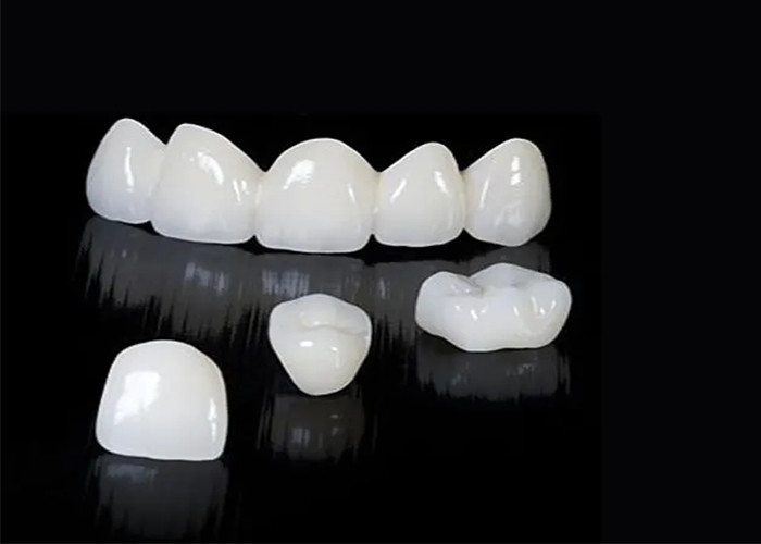Corona dentale di zirconia traslucida su misura resistente alle macchie