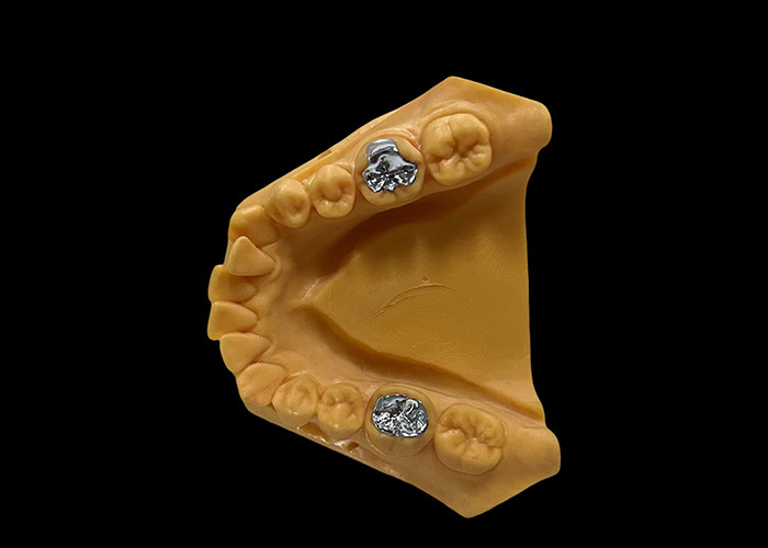 Porcellana fusa al metallo PFM corona resistenza all'usura dentale per la odontoiatria restauratrice