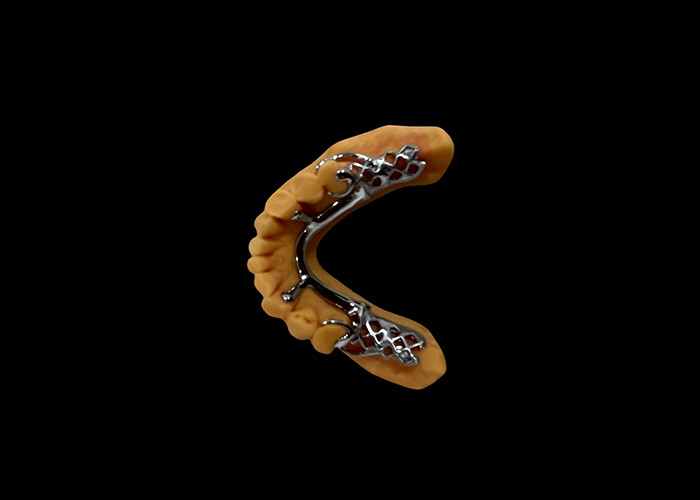 Denti rimovibili parziali a base metallica e resina acrilica per un'aspetto sicuro e naturale