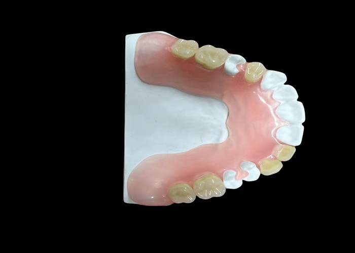 Protesi dentali in acrilico completo Leggerezza Durata Soluzione conveniente e personalizzabile per la sostituzione completa dei denti