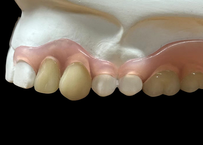 Protesi flessibile invisibile regolabile: sicura per masticare e parlare comodamente con durabilità variabile