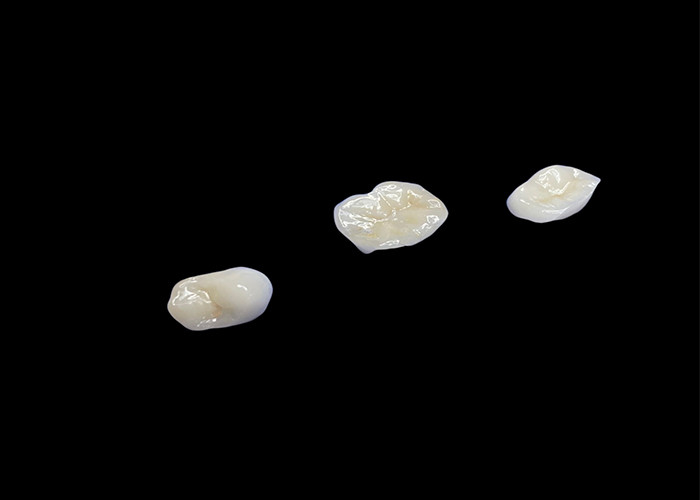 Infissi e infissi in ceramica biocompatibili progettati per una durabilità confortevole e un'integrazione senza soluzione di continuità con i denti naturali