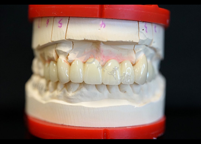 Forza Estetica naturale Corona di zirconia solida Perfetta per denti singoli o multipli