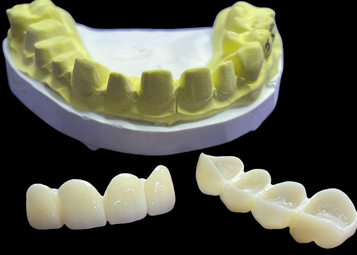 Corone e ponti di porcellana dentale resistenti alle macchie in tonalità classiche Vita per estetica naturale