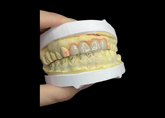 Corone e ponti di porcellana dentale resistenti alle macchie in tonalità classiche Vita per estetica naturale