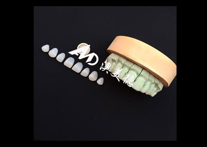 Trasforma il tuo sorriso con IPS emax Pressa Vene di porcellana Forza Estetica e durata combinate