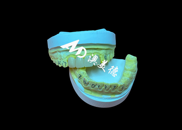 Restauro dentale Corona dentale a zirconia traslucida per un'idoneità precisa ed estetica naturale