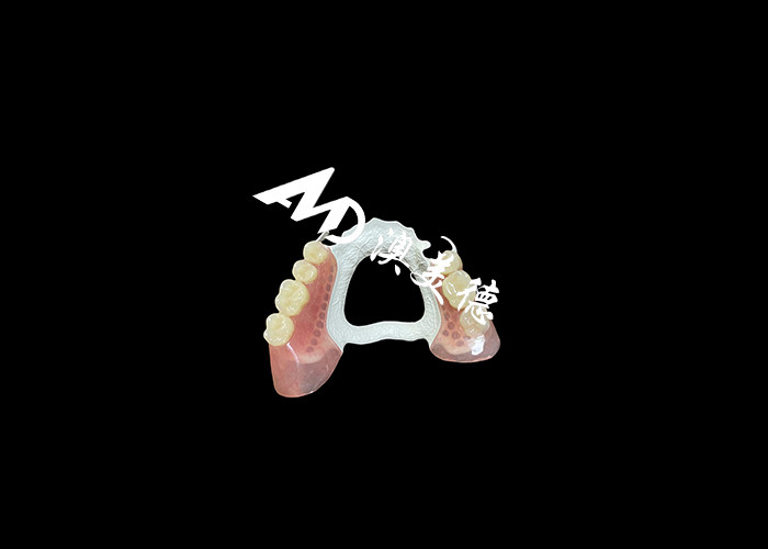 Denti rimovibili di alta qualità con struttura HPP resistente e base acrilica comoda per un'adattamento sicuro e prestazioni durature