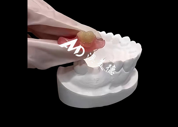 Le protesi flessibili Nesbite offrono una soluzione perfetta per un sorriso confortevole e naturale