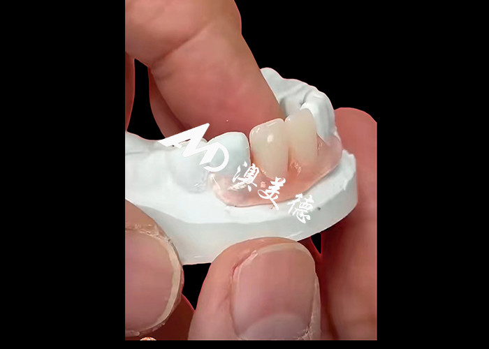 Le protesi flessibili Nesbite offrono una soluzione perfetta per un sorriso confortevole e naturale