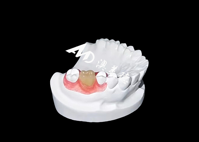 Le protesi flessibili Nesbite offrono una soluzione perfetta per un sorriso confortevole e naturale