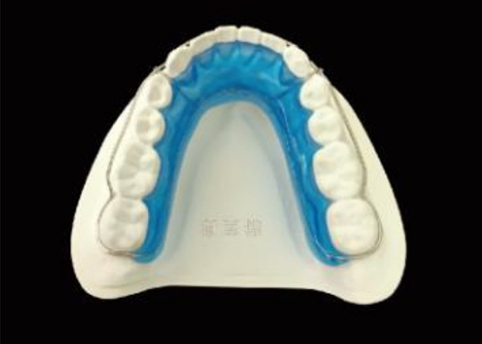 Mantenete il vostro sorriso con il supporto per l'allineamento perfetto e risultati duraturi