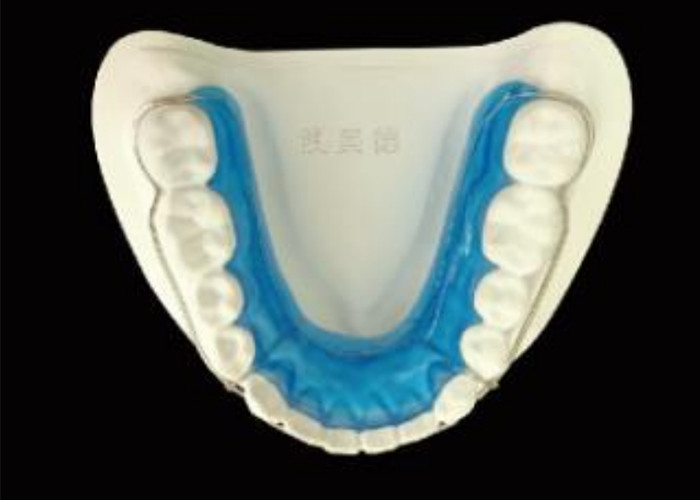 Mantenete il vostro sorriso con il supporto per l'allineamento perfetto e risultati duraturi