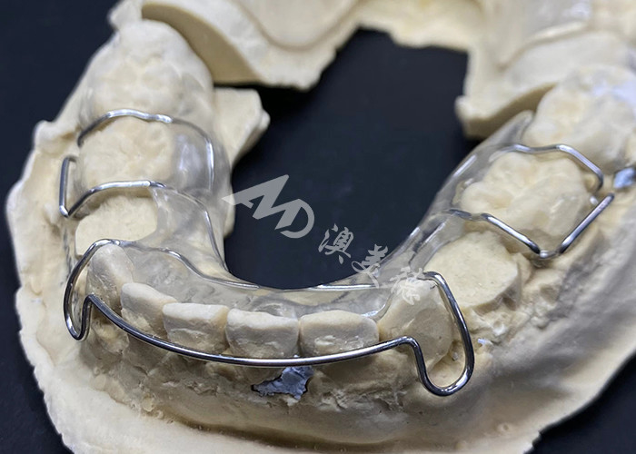 Confortevole da indossare il conservatore Hawley dell'AMD Dental Lab per un'ortodonzia sicura e sana