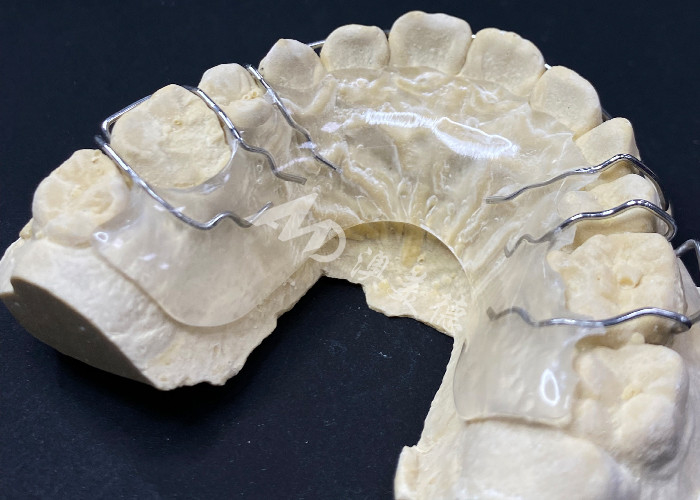 Apparecchi ortodontici per la correzione dell'allineamento dei denti