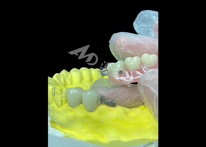 La soluzione definitiva per comfort ed estetica