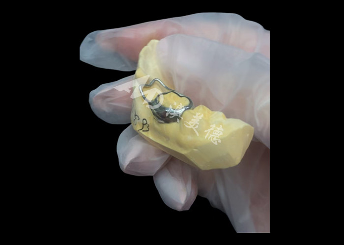Ortodontic Space maintainer un inestimabile dispositivo che protegge ingegnosamente gli spazi dentali dei bambini assicurando il corretto sviluppo dei denti.