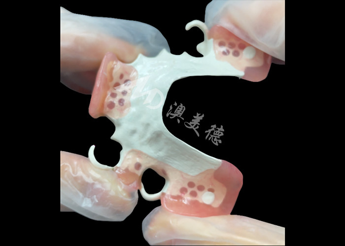 Estetica Denti parziali rimovibili realizzati su misura HPP Quadro per la sostituzione parziale naturale dei denti