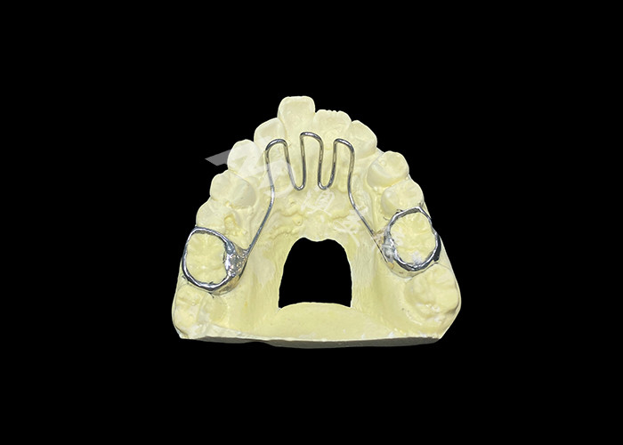 Culle della lingua Apparecchio ortodontico utilizzato per risolvere problemi di spinta della lingua e aiutare nel corretto allineamento dentale
