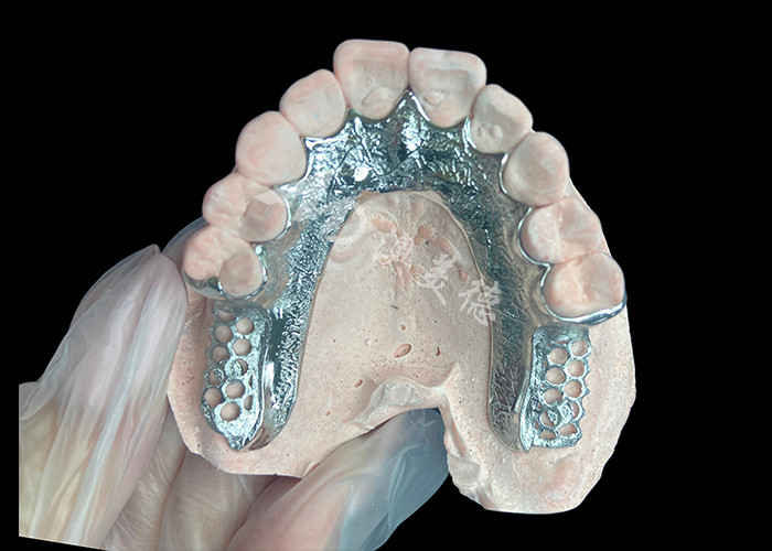 Dentistico a base di protesi parziali a colata personalizzata senza denti