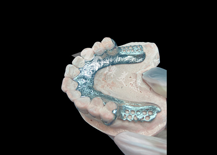 Dentistico a base di protesi parziali a colata personalizzata senza denti