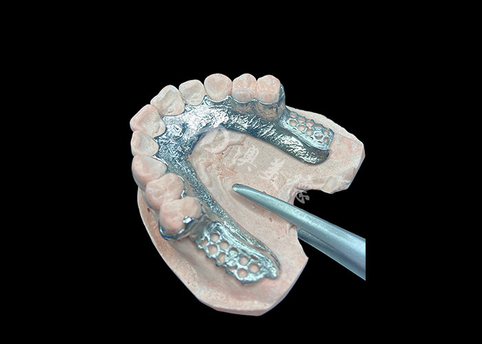 Dentistico a base di protesi parziali a colata personalizzata senza denti