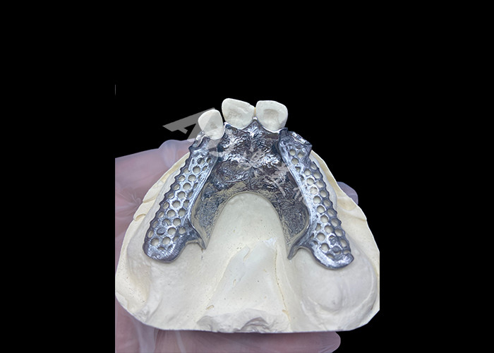 Easy Fit Custom Cast Parziale Protesi Stabile e naturale struttura per risultati rapidi